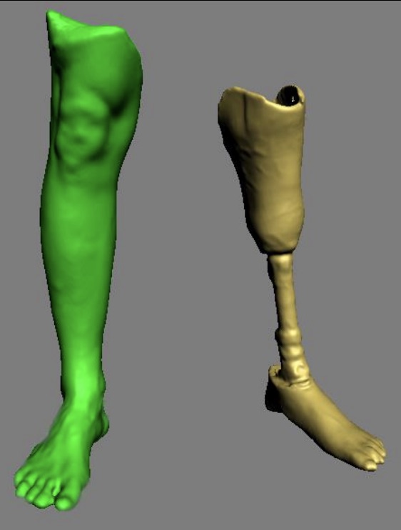 Esthétique pour prothèse de jambe imprimée en 3D